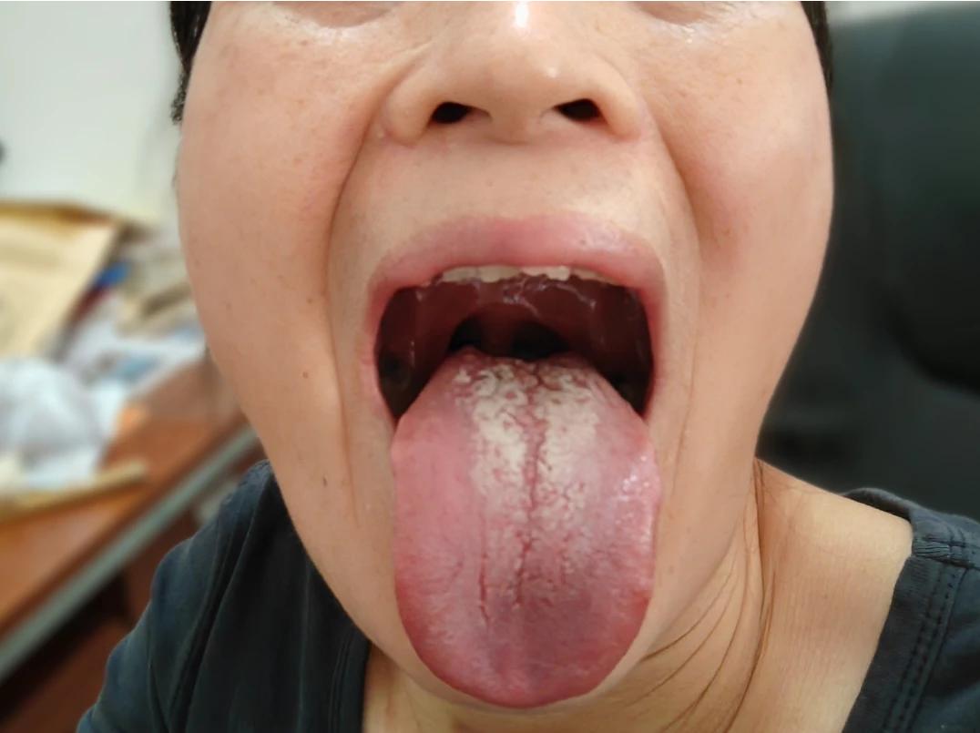 看看我这是些什么问题呀？