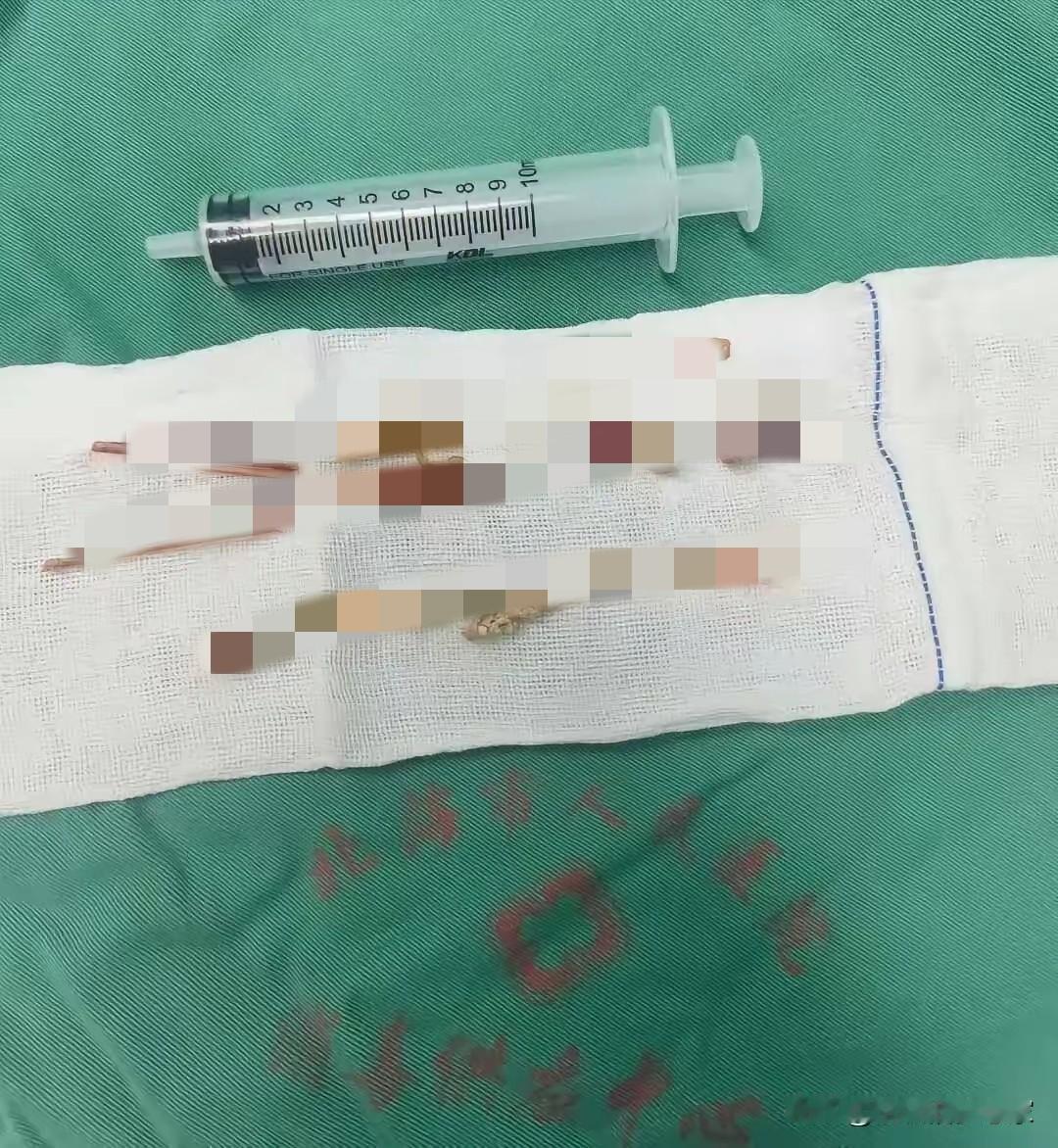 这大哥对自己是真狠！20年啊！
 
刷到这个新闻真是服了，刷新三观
广东一男子就