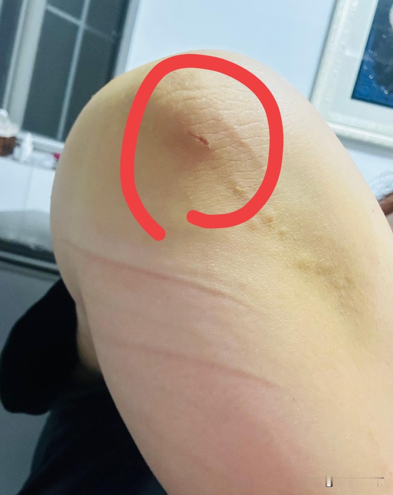 为我的真诚创作点赞！ 👍❤️🔥你也快来发布一条吧！带记录真实生活话题，更容易