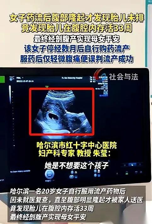 [微风]1月16日发布，哈尔滨一个20岁的姑娘，吃药想把孩子打掉。结果B超探头一