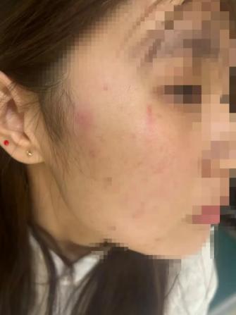 山东东营，18岁的女孩，独自在家被陌生人敲门，门打开后，对方称自己的儿子被女孩的