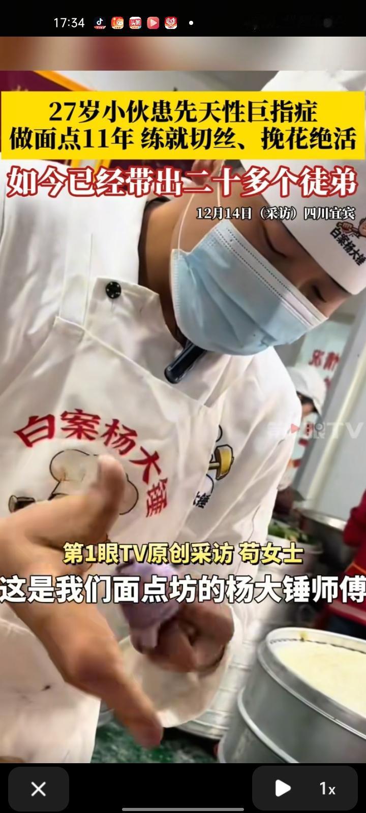 12月14日，宜宾市江安县。小伙的右手患先天巨指症，16岁那年就学做面点当学徒，