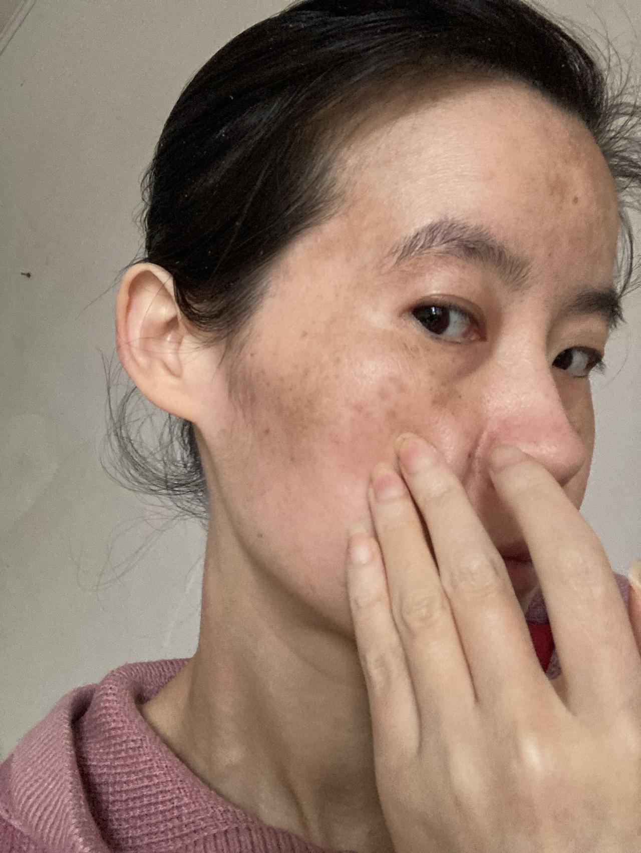 今天外面温度合适，就是风大。

未成年得强直性脊柱炎，对我这一生影响大吗？肯定是