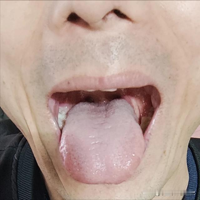 这舌头[惊呆][惊呆][惊呆]大哥你都脾肾两虚了[捂脸][捂脸]还能有劲嘛
[打