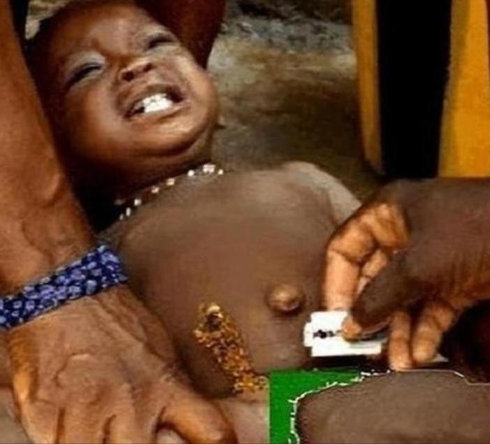 非洲有一项存在了3000多年的陋习。女孩5岁时，在没有麻醉的情况下，被女性长辈用