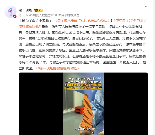 中年男子异物卡肛门硬扛致肠穿孔男子成人用品卡肛门就医后拒取出 深圳有位中年男性，