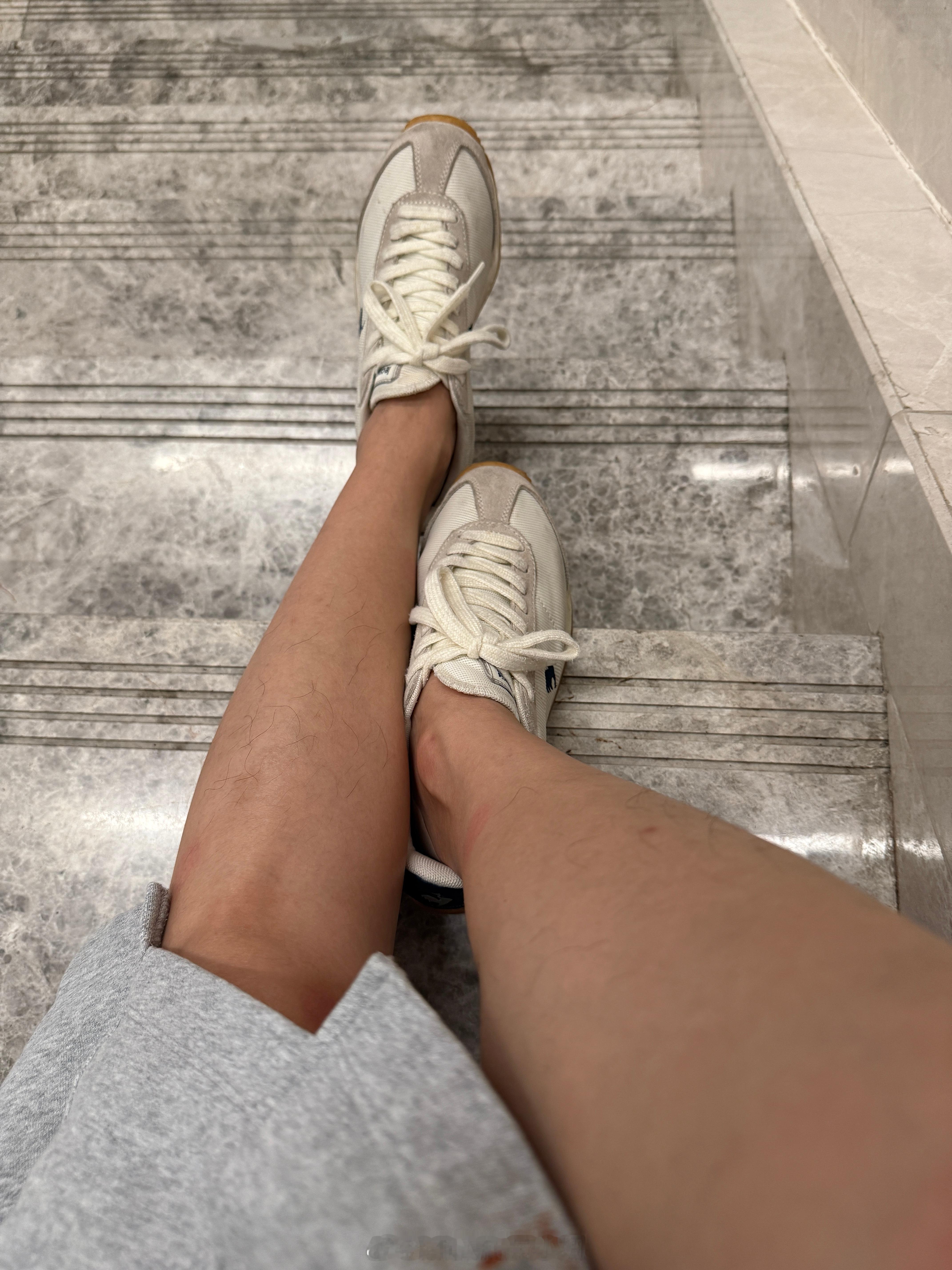 男子怀疑汽车静电导致双腿脱毛这功能我喜欢啊[喵喵]现在天天开电车了，让我看看一年