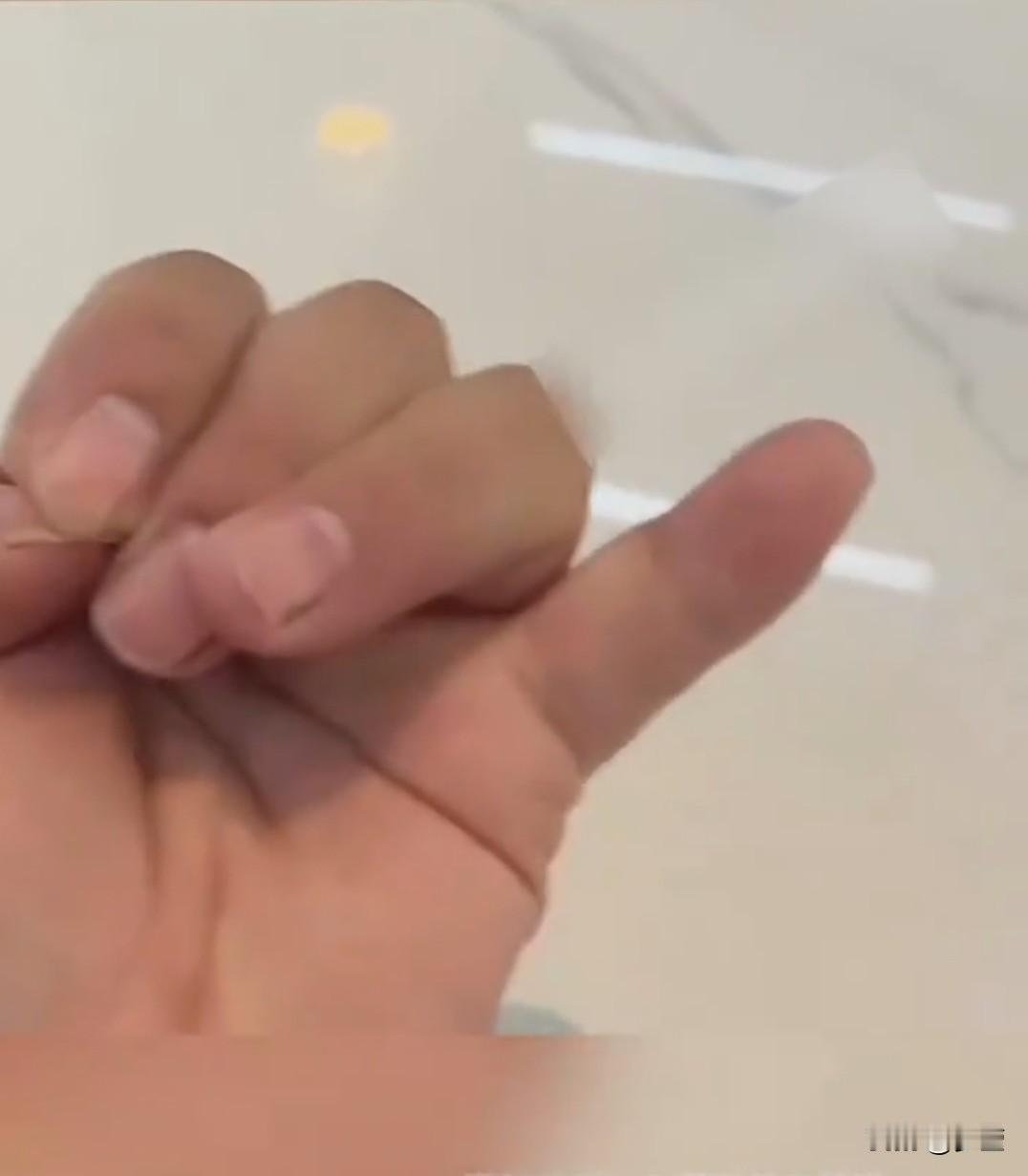 网上一男子晒出了自己的手
他的尾指竟然只有两节
我赶紧伸出了自己的手
数了一数