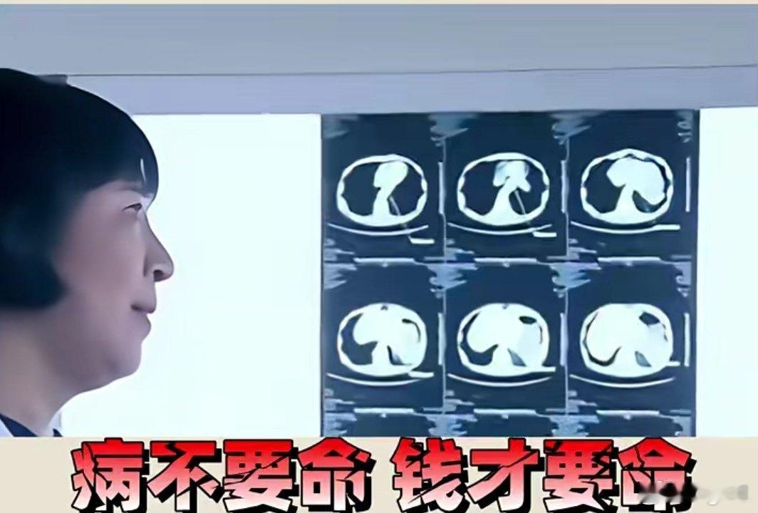 病不要命，但你这看病的方式要命啊。这单纯只是钱的问题？虽然是保险公司拿来宣传的案