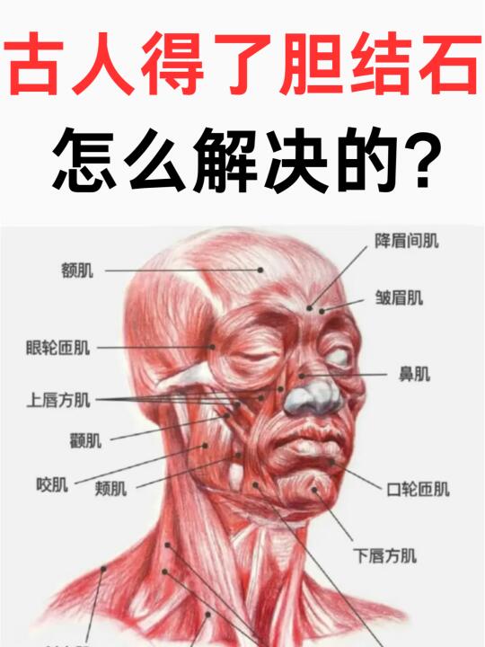 古人得了胆结石，怎么解决的？