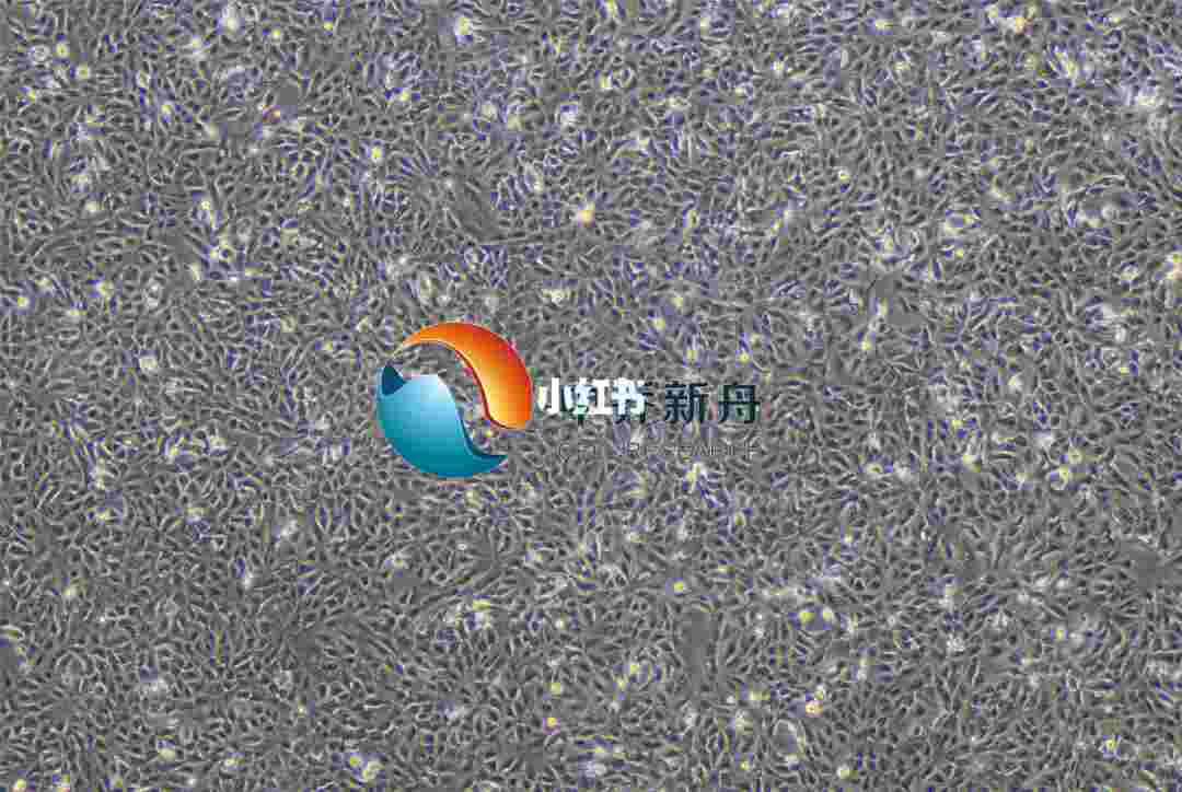 RBE人肝胆管癌细胞