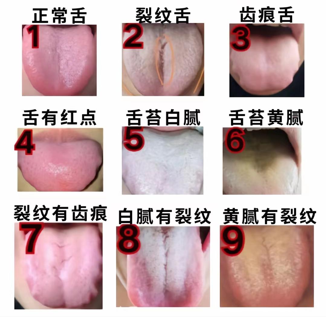 今天不是很忙，可以抽出时间分析舌象，看看你是哪一种？

#养生##健康##中医#