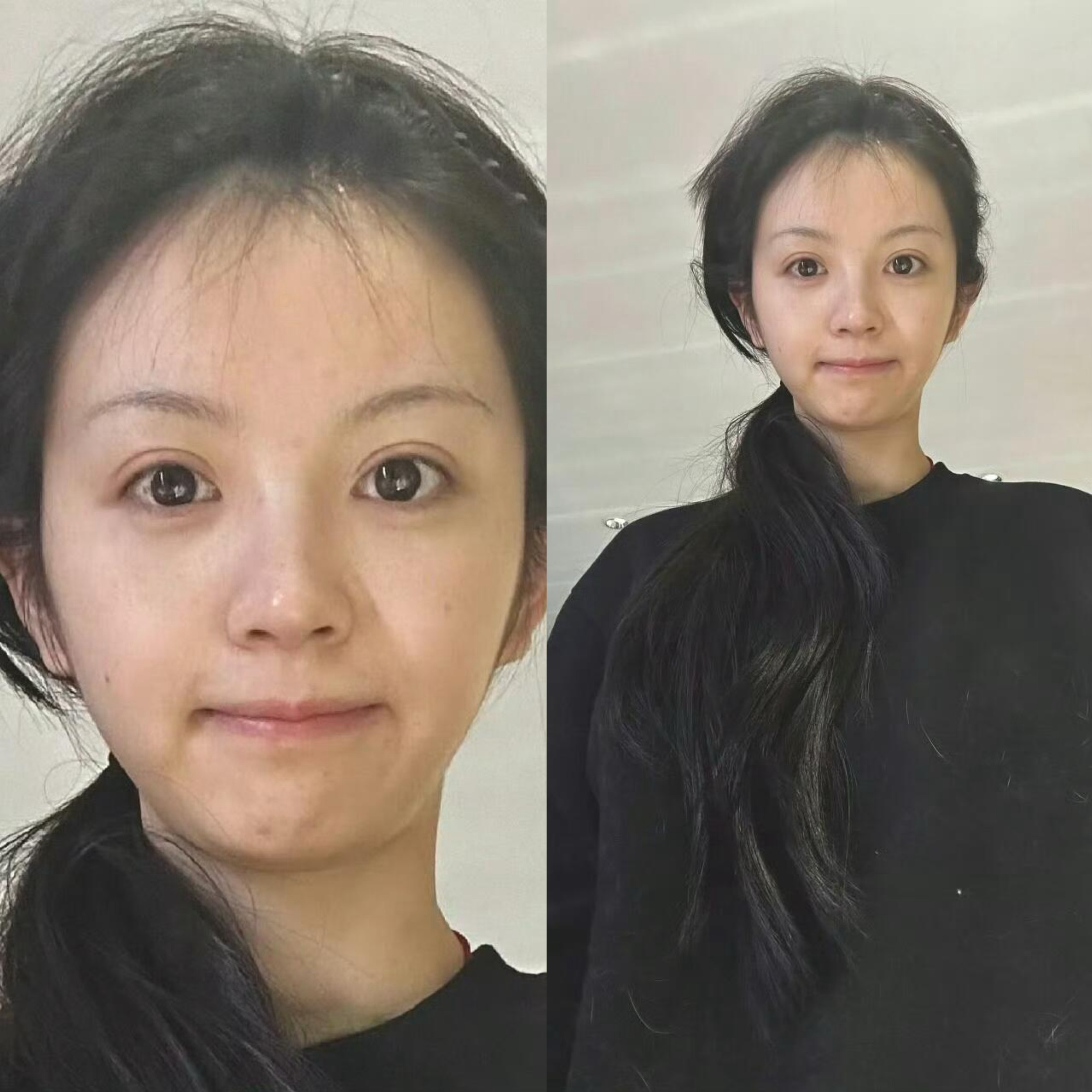 田曦薇素颜状态好真实，连皮肤的毛孔和小痘印都清晰可见。 