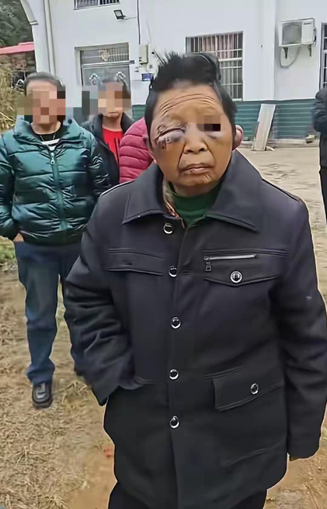 儿子算白养了，母亲长期被家暴，儿子都开始工作了，还保护不了妈妈，也真够废的，小时