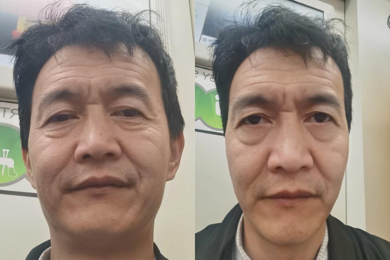 手机拍摄，如何控制镜头失真，是一个相当严重的问题。
需要在未来摄像头固件算法中得