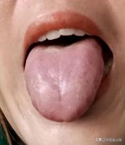 肾虚多淫、肝虚多软、脾虚多痰，一盒中成药，补足五脏虚
肾虚多淫
表现：欲望强、能