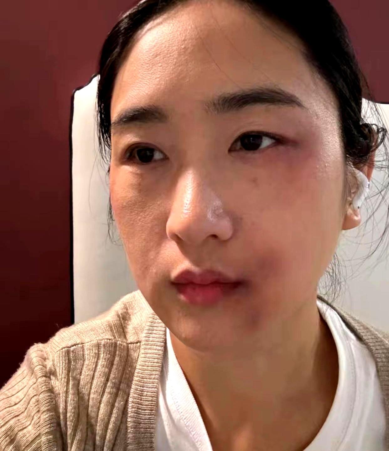 灯还亮着时，巴掌已经落下，三个月的孕期，屋里只剩屏幕的白光。
丈夫替亲妈“出气”