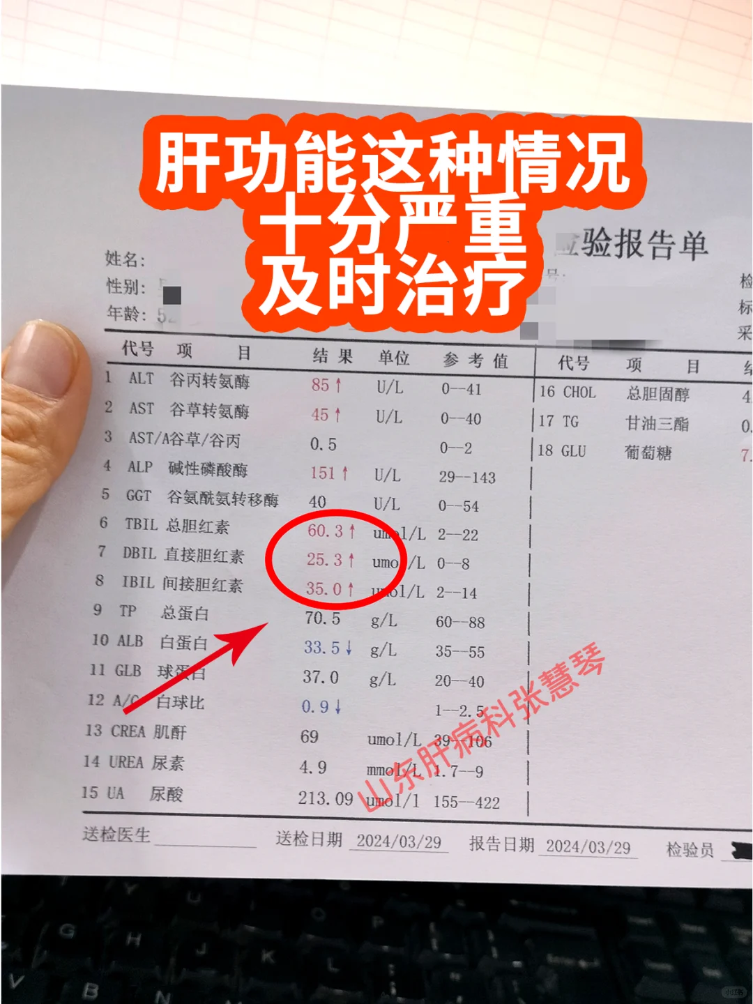 肝功能出现这些箭头十分严重，需及时治疗