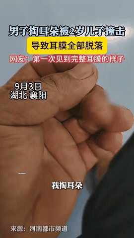 “吓得我再也不敢掏耳朵了”！湖北襄阳，男子感觉耳朵有点痒，就随手拿出掏耳勺掏耳朵