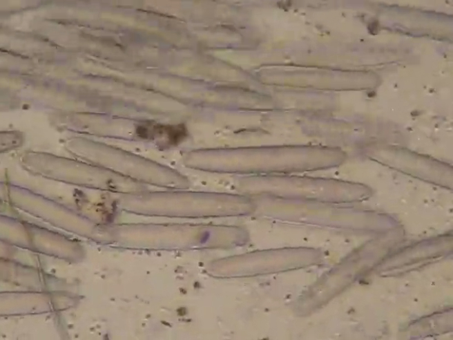 #每天一条冷知识#巨型细菌可以有多大？科学家在刺尾鱼的肠道内发现了一种细菌，称为