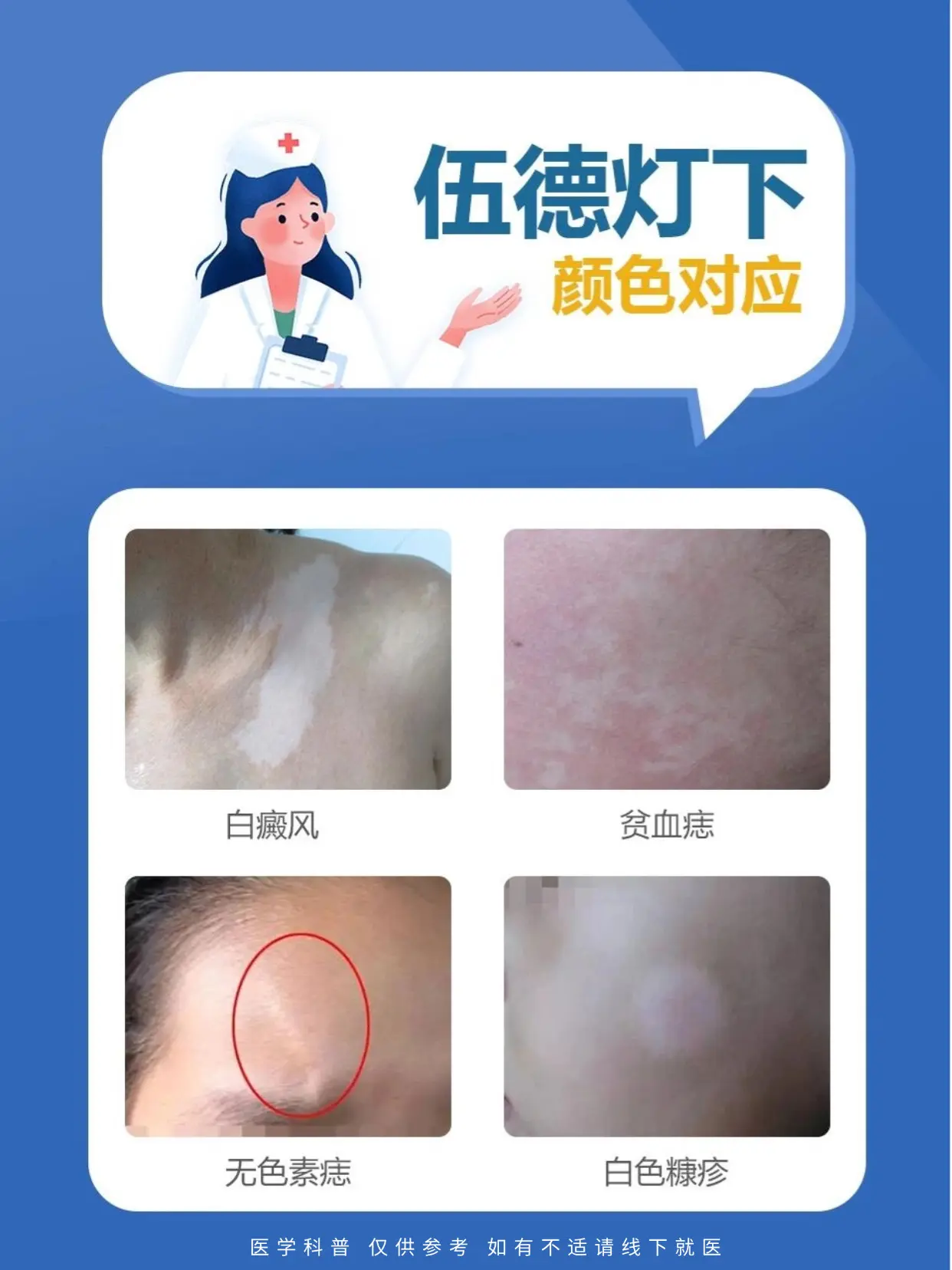 医学科普 白癜风 白癜风科普 硬核健康科普行动  白斑