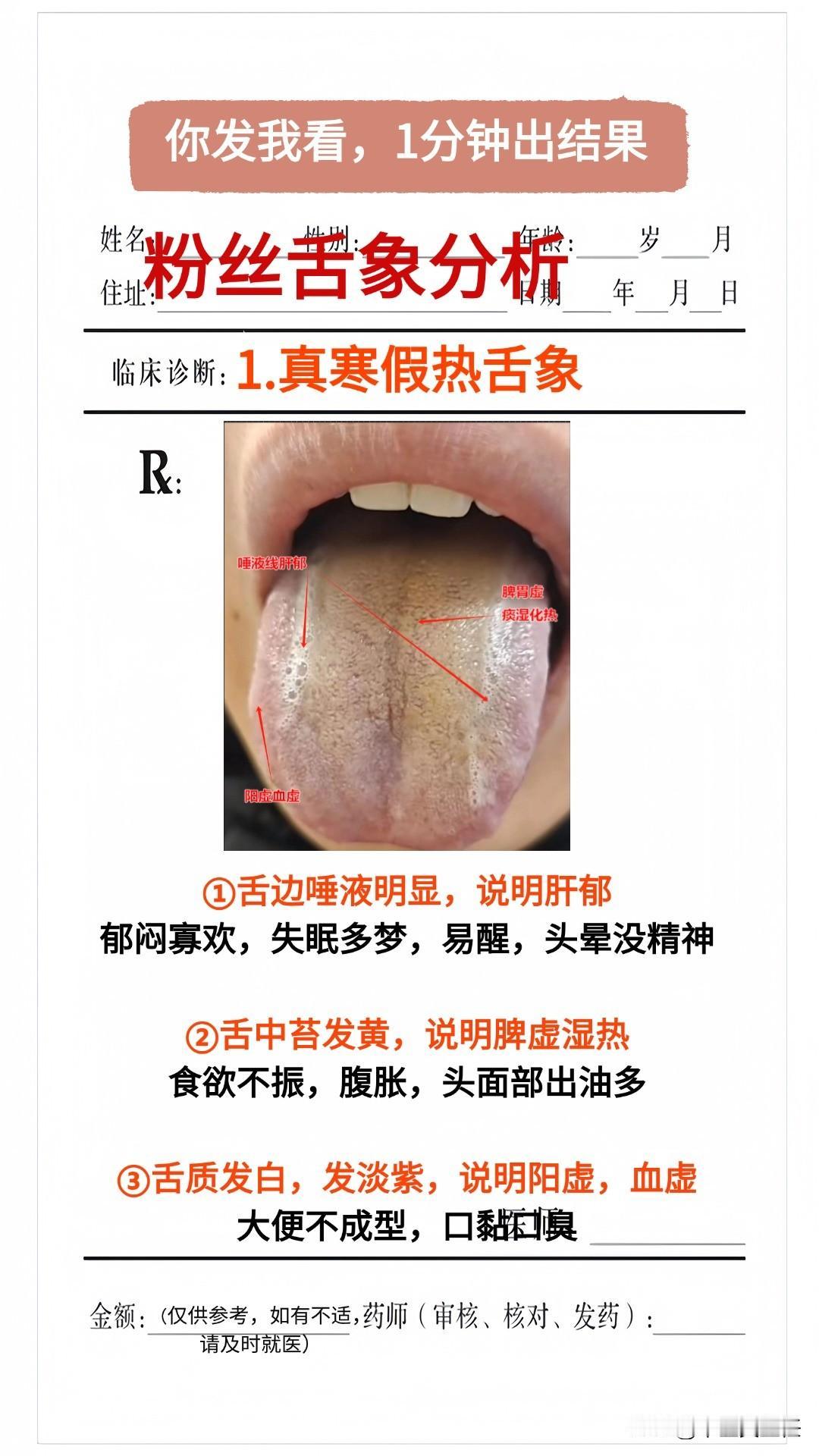 坚持公益看舌的第48天，本月已经看了325个舌象！你拍，我看，1分钟现出结果！
