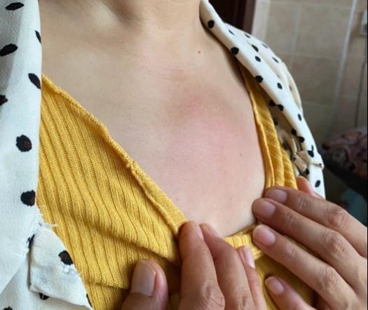 近日，河南19岁女子因乳房疼痛就医，竟查出乳腺内有100多个结节。医生称从业26