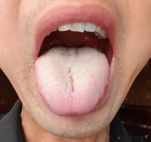 看着像是阳虚，你就大力温阳[what]简直错的离谱[发怒][发怒][发怒]
患者
