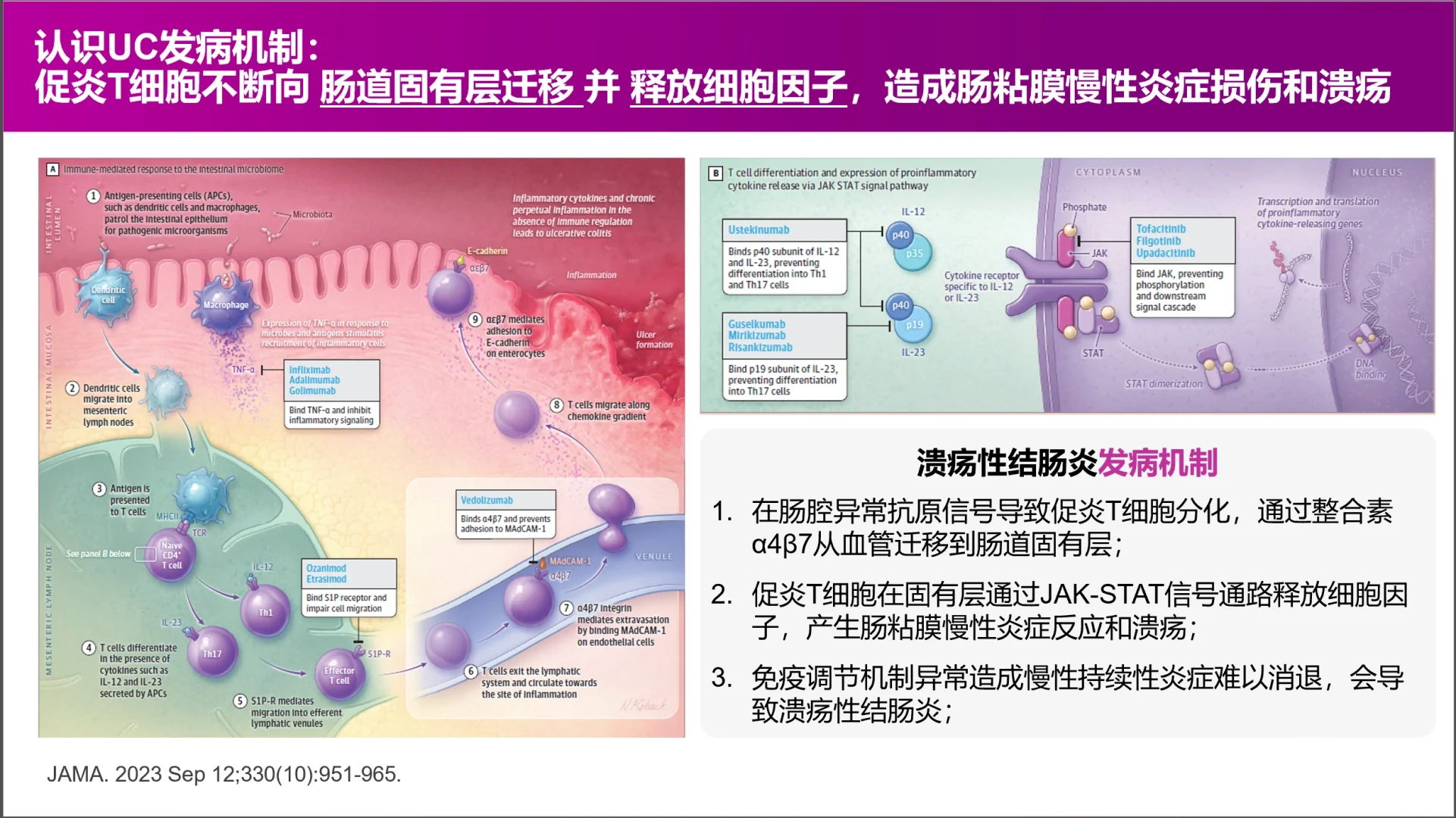 还有患者在问溃疡性结肠炎是否能治愈