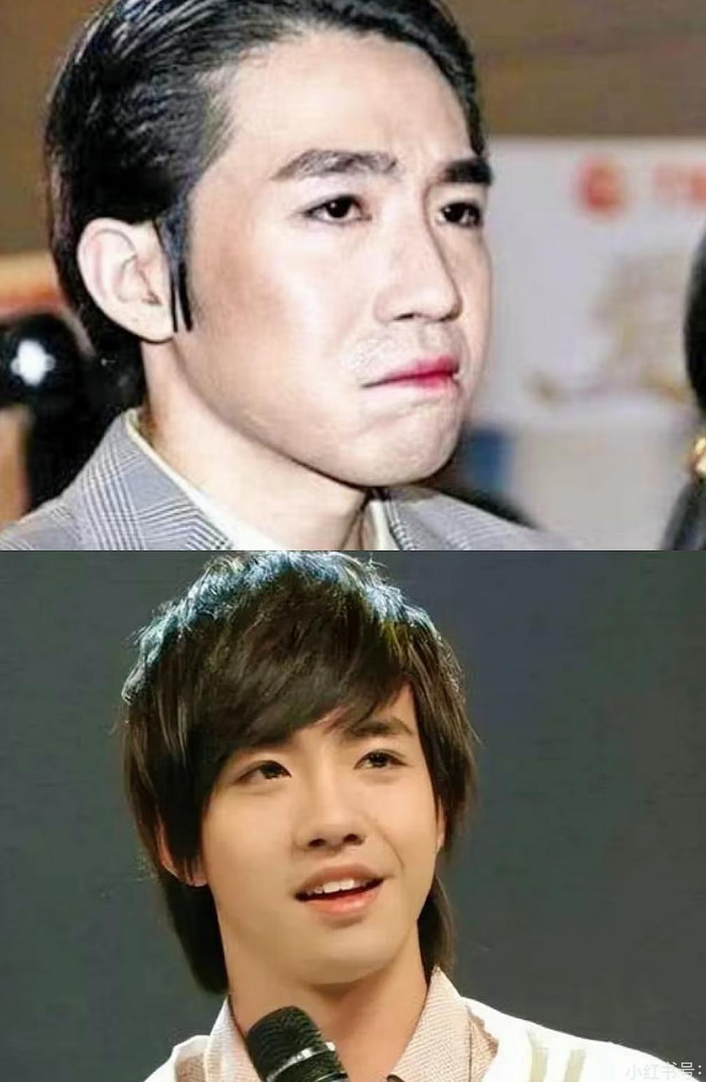 俞灏明这十五年，才是内娱最体面的逆风翻盘。

大火毁容后被女友抛弃，他明明握着一