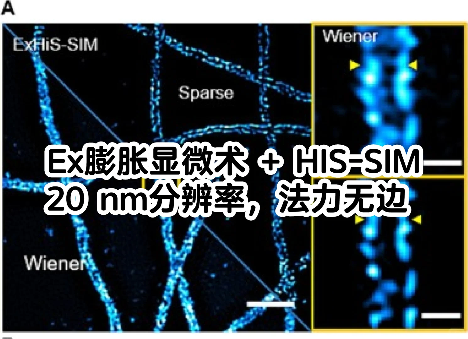 首篇！膨胀显微术搭配HIS+SIM，突破20nm！