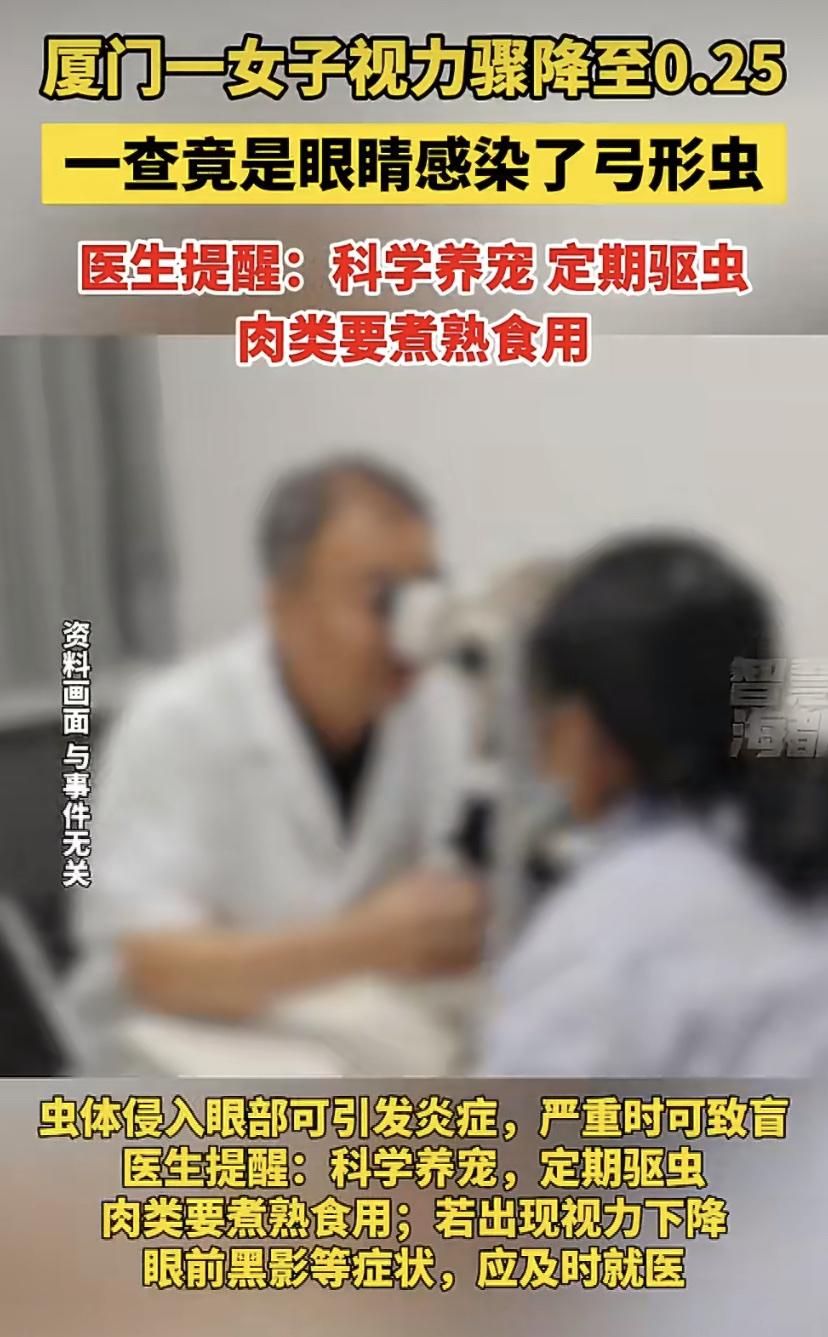 女子眼前突现"飞虫"险失明!医生一问：爱吃五分熟牛肉，家里还养猫
厦门39岁的周