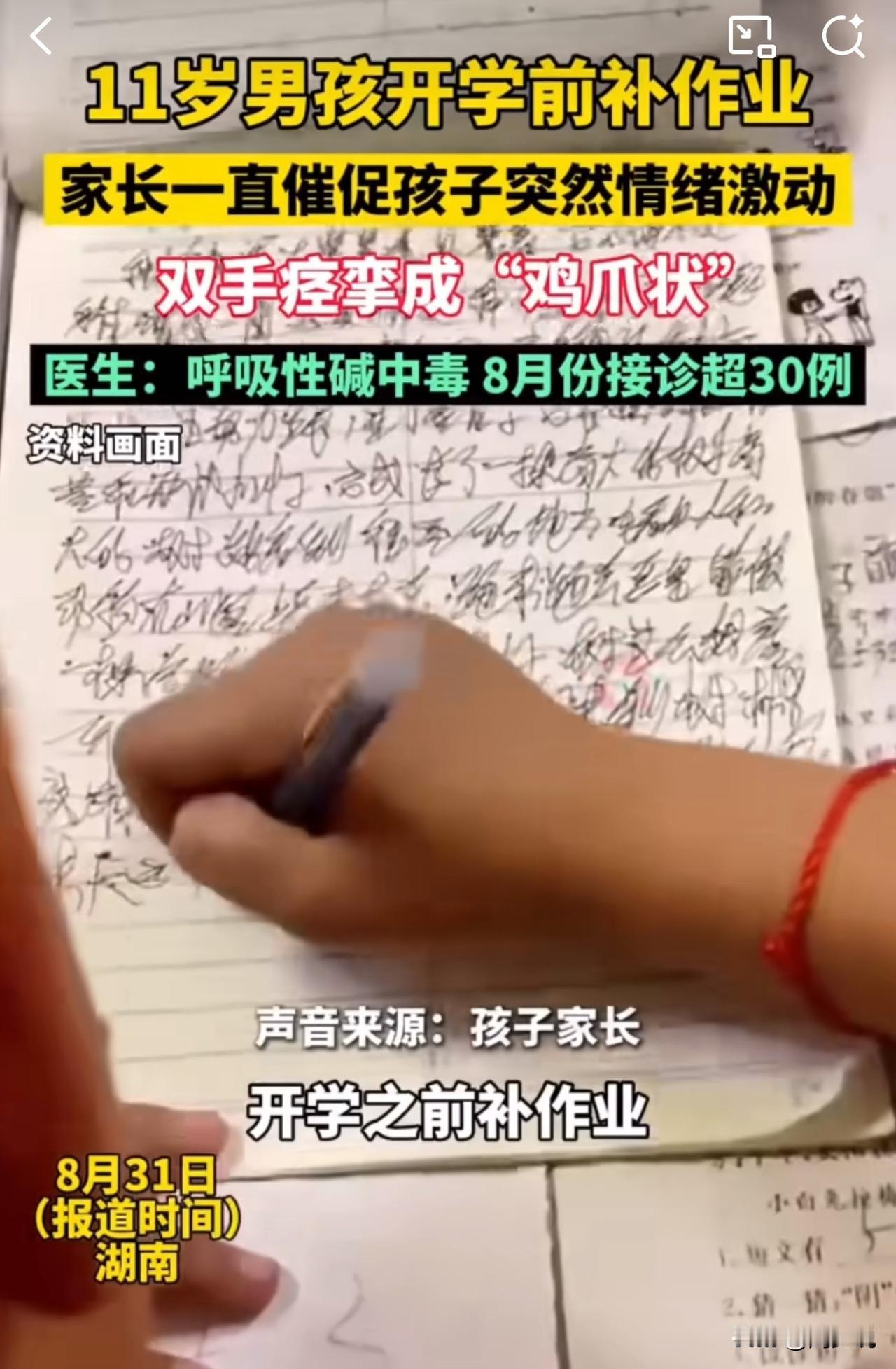 可怕！11岁男孩赶14小时作业，双手痉挛成“鸡爪状”！

据媒体报道消息，湖南一