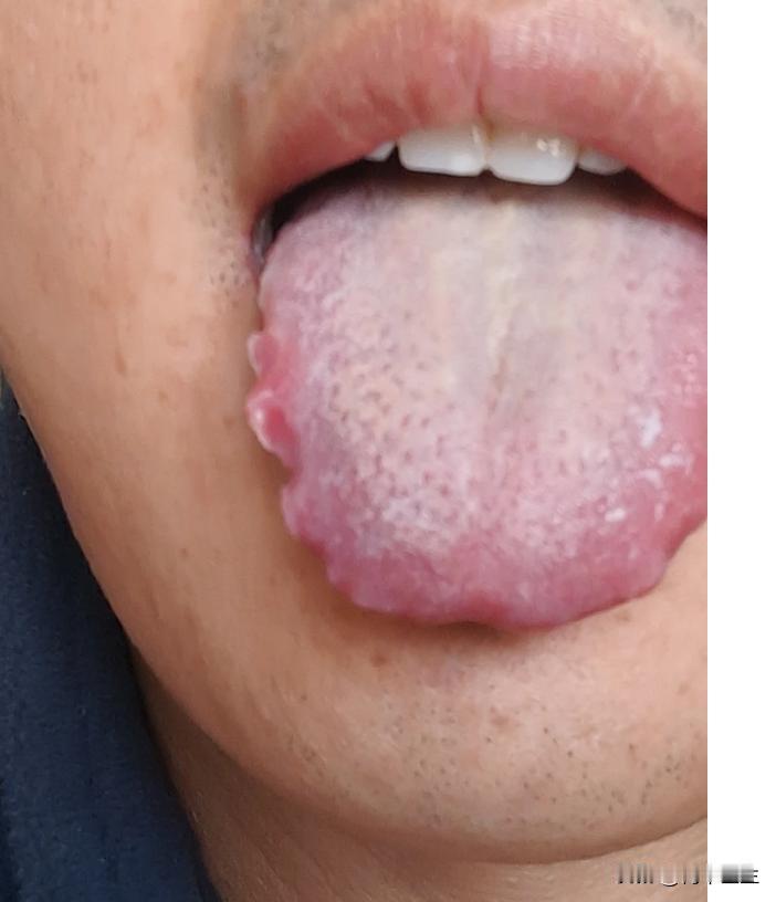 这小伙子都奔三了，该有明辨是非的能力了吧，那些祛湿的药试了一遍又一遍，有没有效果