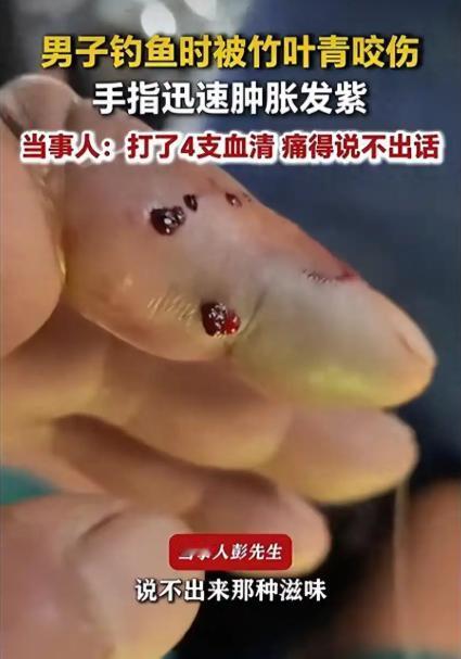 “太险了！”9月12日报道，广西河池，一男子钓鱼时，手指传来一阵刺痛，他低头一看