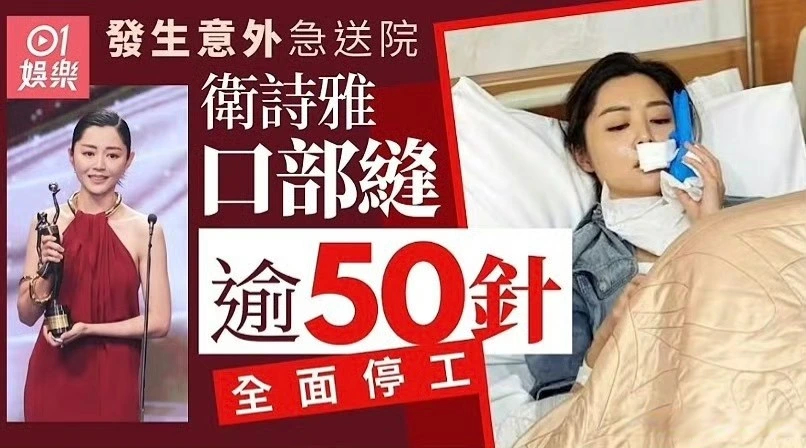 揪心！卫诗雅片场意外受伤，口部缝超50针全面停工7月30日，金像影后卫诗雅拍摄悬