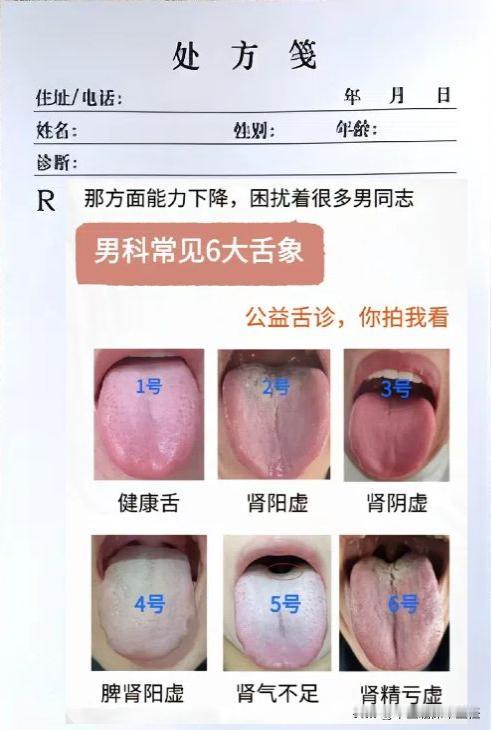 转眼又到周六了，今天还是老样子，给大家看看舌象吧！

你来发舌头照片，我来辨证分