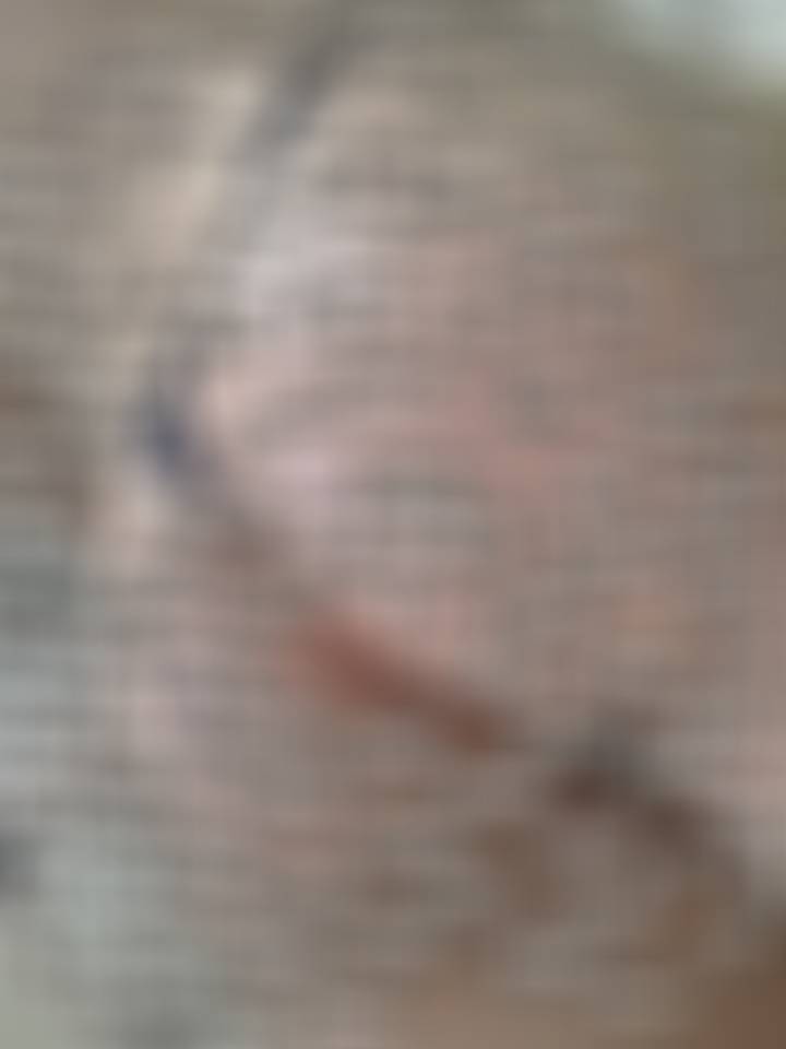 P股长了个痘 ​​​