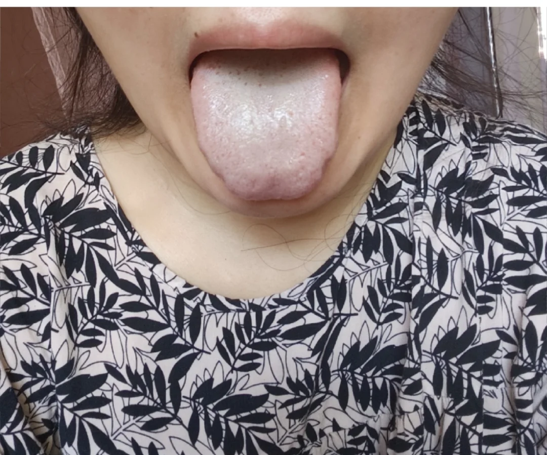 右滑帮我刷舌头