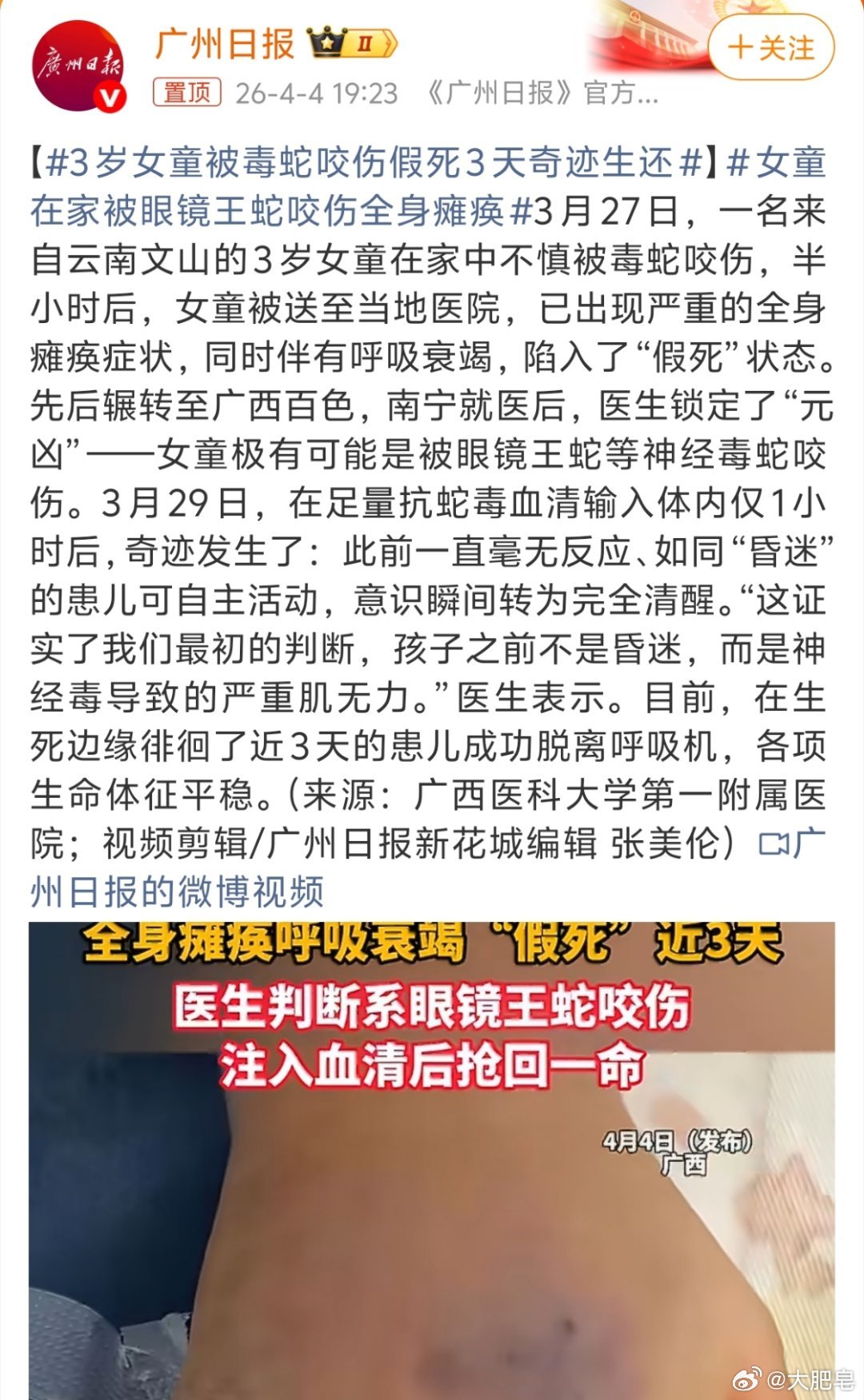 3岁女童被毒蛇咬伤假死3天奇迹生还 总听说古时候人死后要三天后下葬，是不是就是因