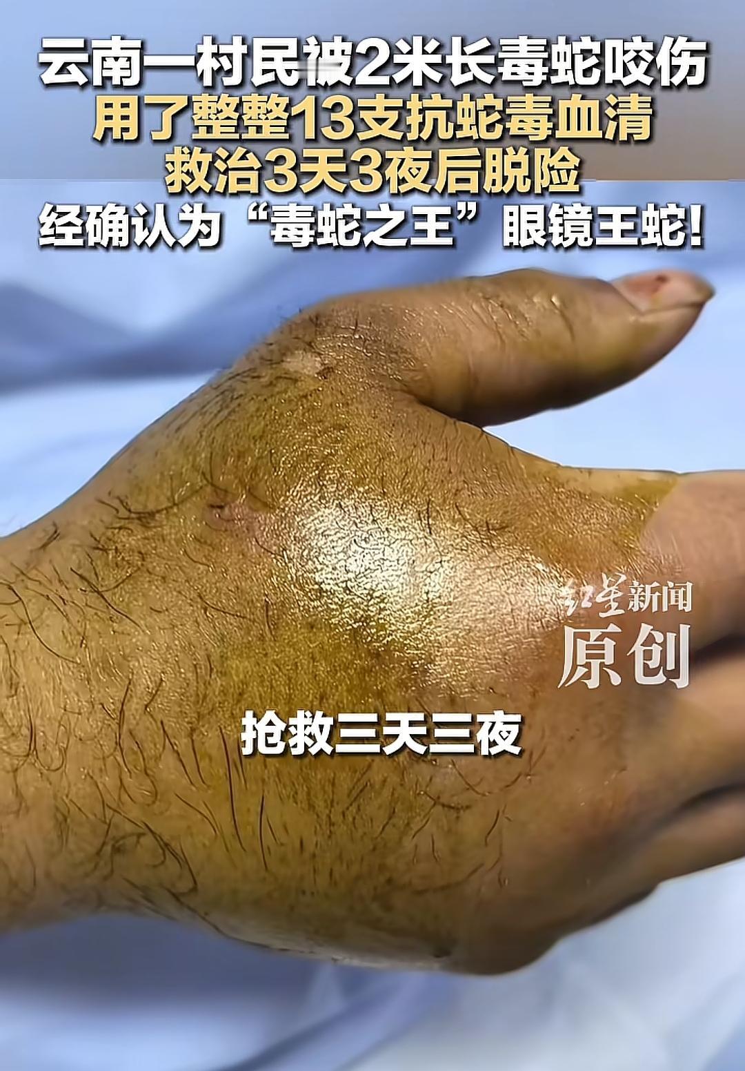 13支血清，犹如生命的救赎之钥。在紧迫的72小时时限内，它们承载着生的希望，只为