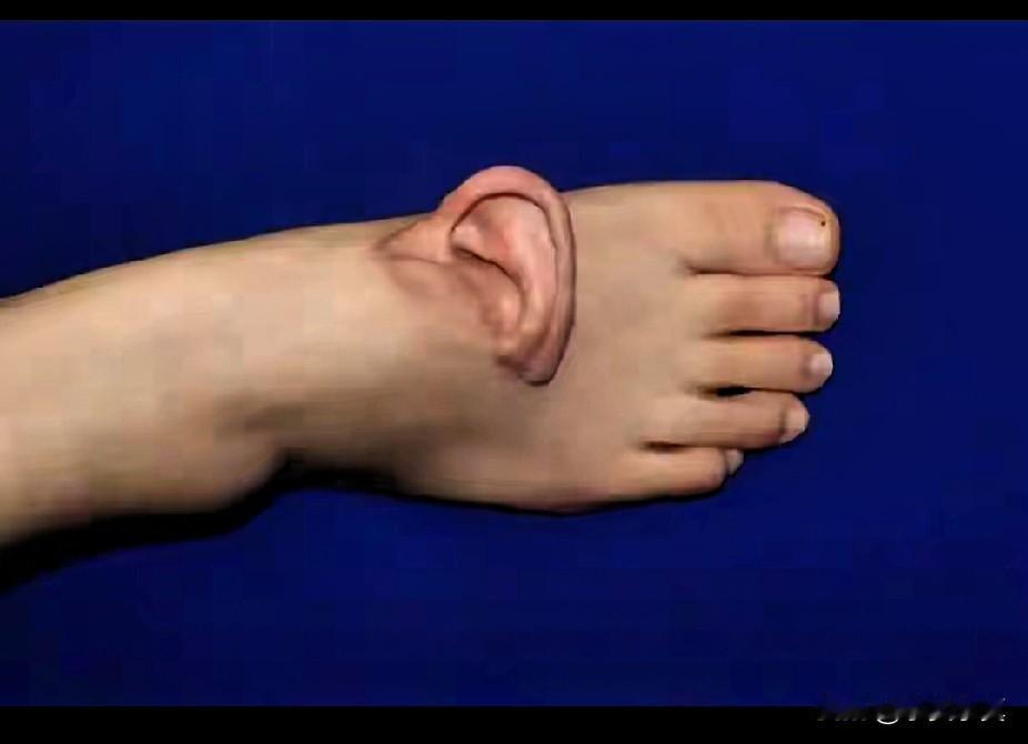 长在脚背上耳朵，
 
济南街头的一声意外，让孙女士的人生瞬间坠入深渊。剧烈的撕扯