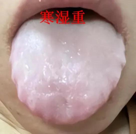 万病皆有寒所起，寒在肾肢冷，寒在脾腹泻，寒在肝头痛，寒在肺咳嗽
 
1. 寒在肾