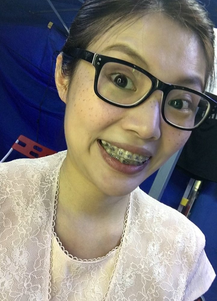 这居然是徐冬冬黑图徐冬冬居然也有颜值尴尬期，看完我都不焦虑了