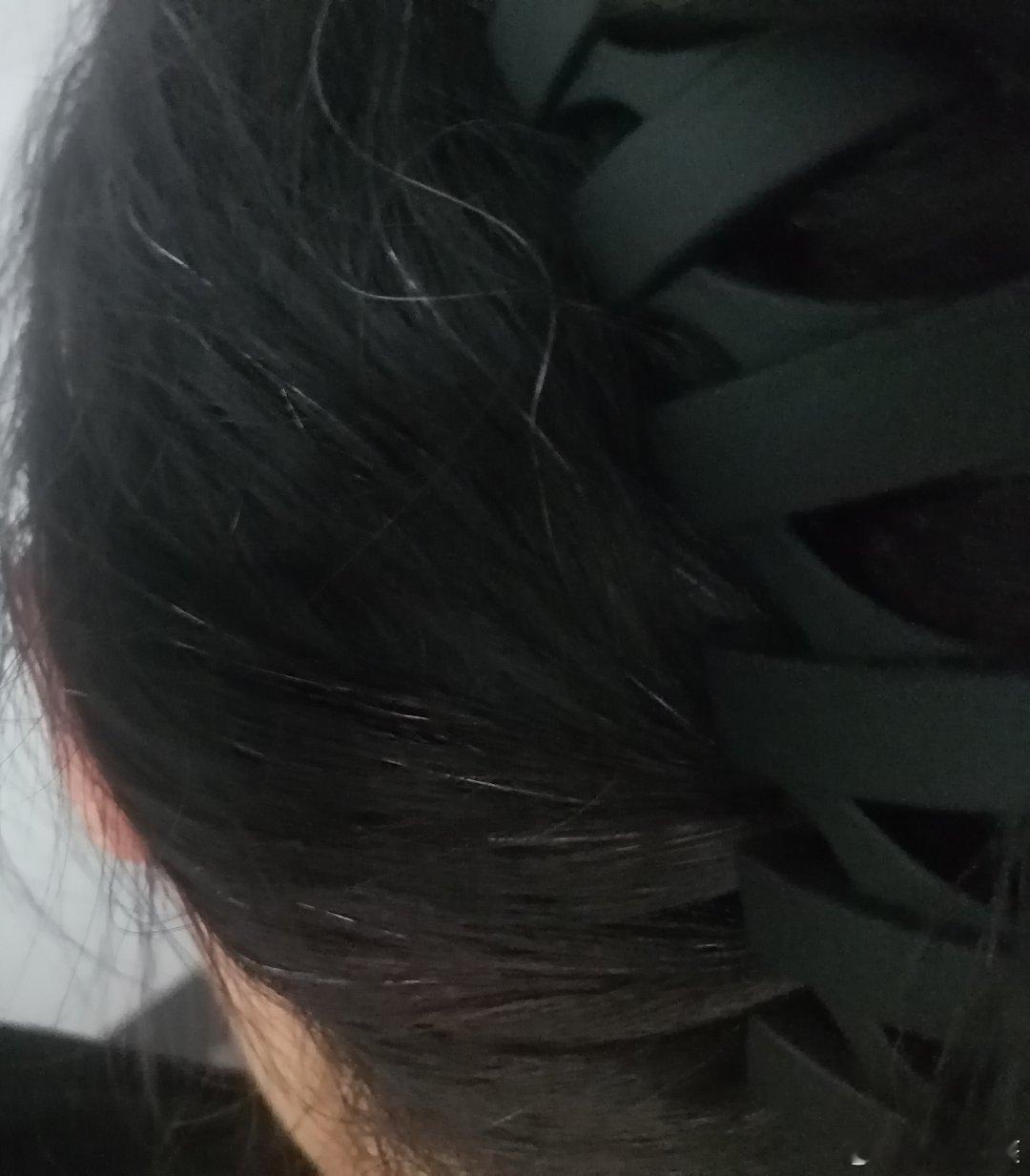 上初中开始就有白头发了，现在更多了生活手记 ​​​