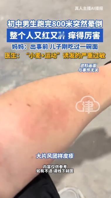 太揪心了！浙江杭州13岁男孩吃完面食跑完八百米，突发全身红肿直接休克，家人此前一