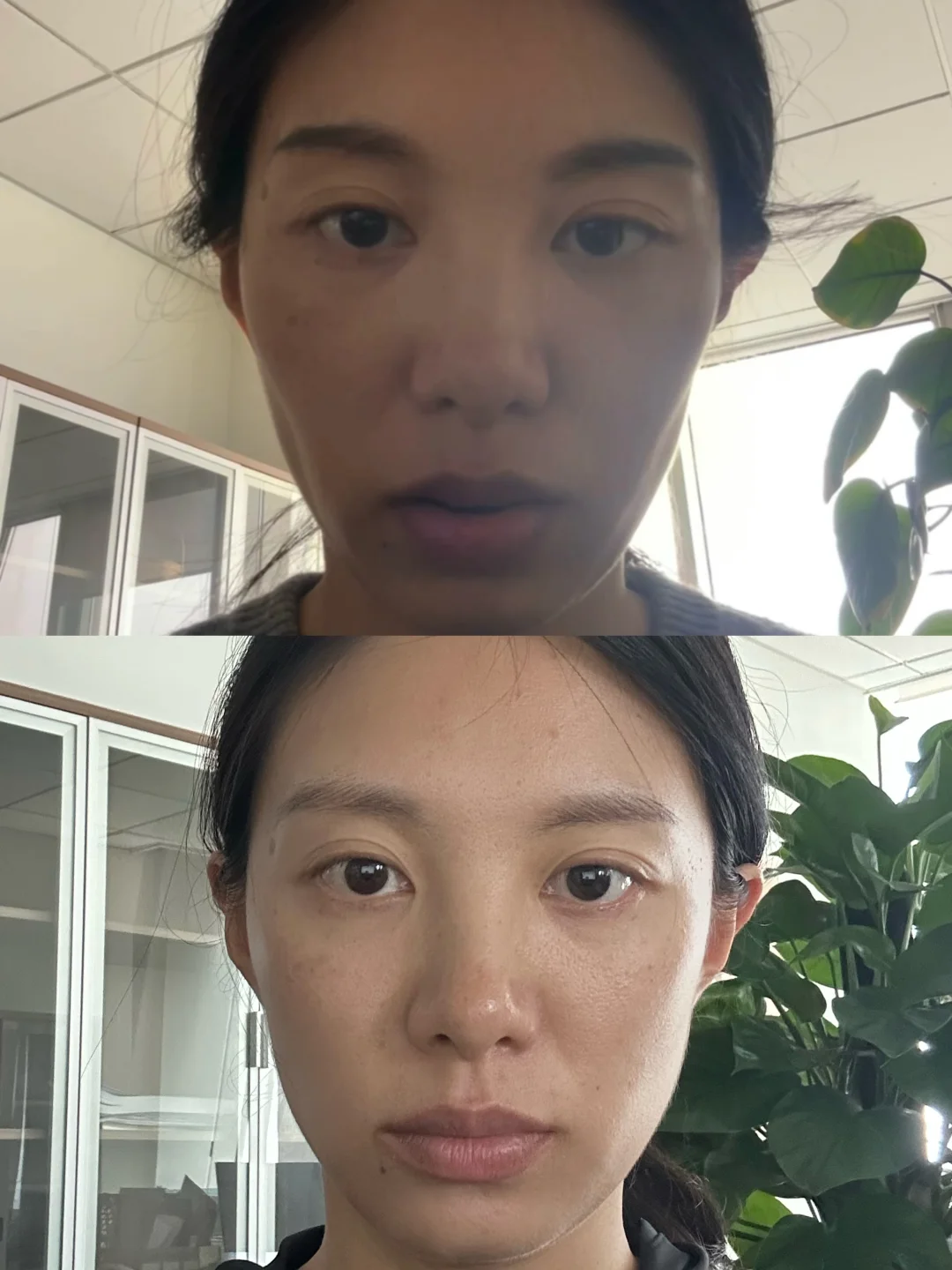 向鹅蛋脸努力的1年！同角度同光源对比！