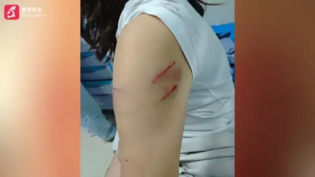 湖南益阳，女子和友人去晨跑，从路边草丛窜出一条流浪狗向她们扑过来，女子吓得赶紧跑