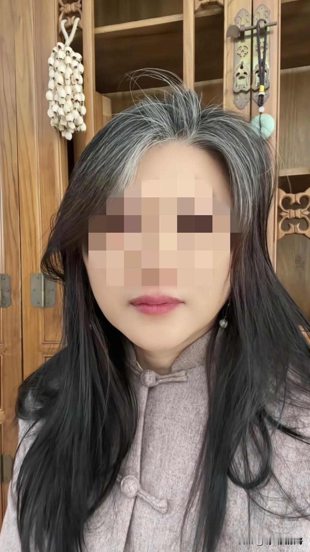 真的有人四十多岁就已经头发花白了吗？