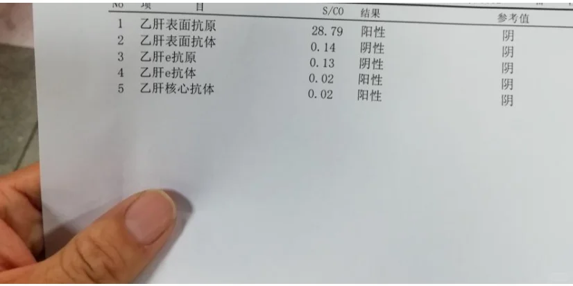 乙肝要做哪些检查? ①乙肝五项:可以判断有没有乙肝,同时也可以区分出大...